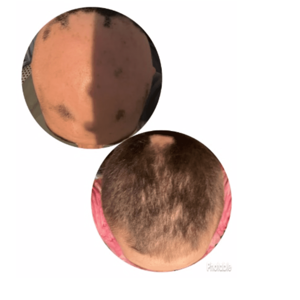 RMG Hemp Balm for Alopecia